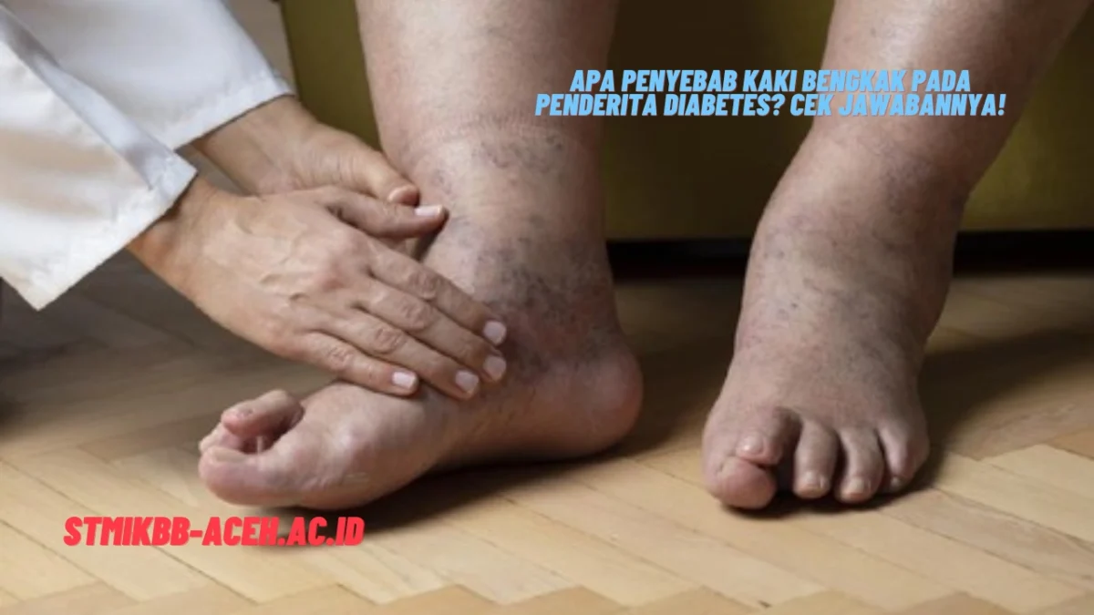 Apa Penyebab Kaki Bengkak pada Penderita Diabetes? Cek Jawabannya!